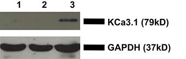 The Role of the Cytoskeleton and Myosin-Vc in the Targeting of KCa3.1 to the Basolateral Membrane of Polarized Epithelial Cells